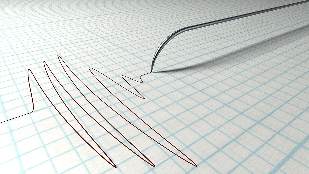Polygraph Needle Drawing graph