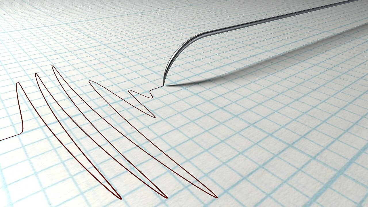 Polygraph Needle Drawing graph