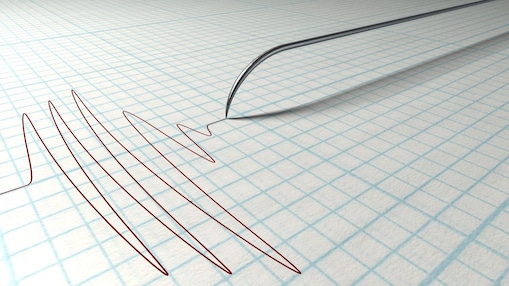 Polygraph Needle Drawing graph